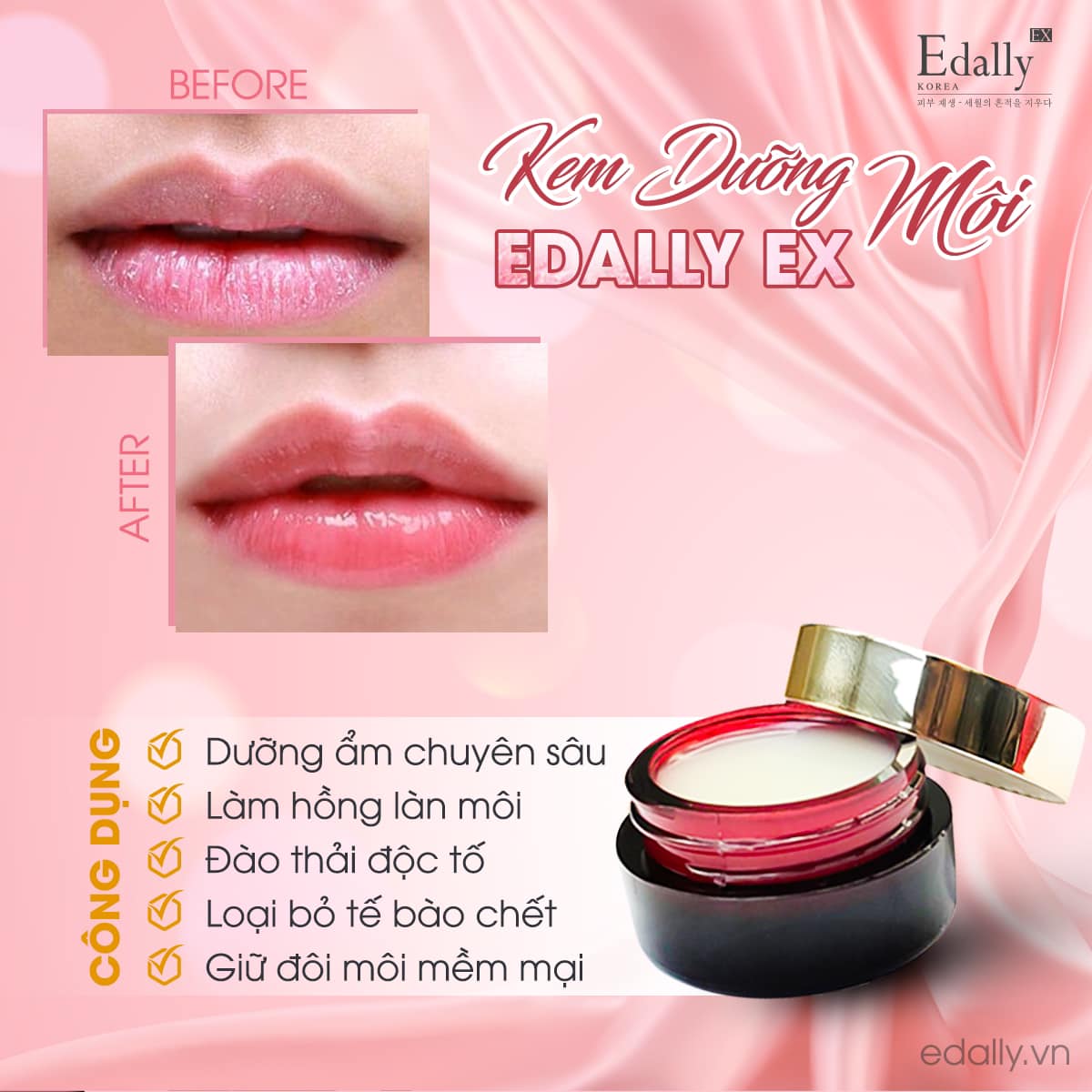KEM DƯỠNG MÔI EDALLY EX 